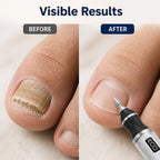 Nailvoro™Electric Nail File & Callus Remover — Effortless Salon-Quality Nails That Boost Your Confidence Instantly
