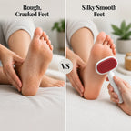 VelvetWalk™— Transform Your Feet into a Soft-Touch Sensation Instantly